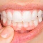 gum health for adults drsabacares.com