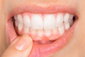 gum health for adults drsabacares.com