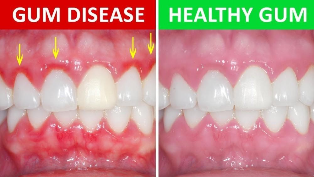 gum health for adults . Dr saba cares