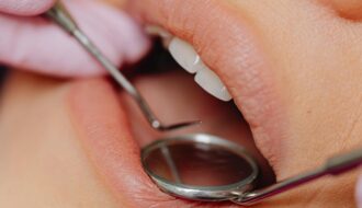 common dental problems in adults