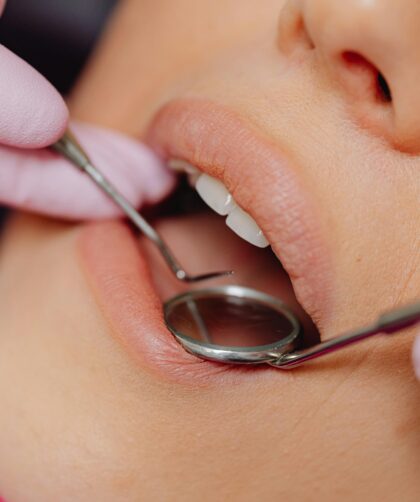 common dental problems in adults