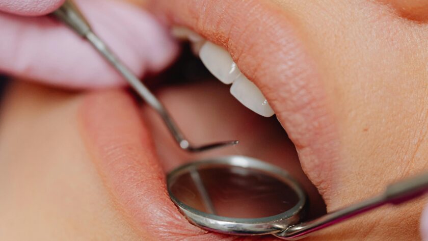common dental problems in adults